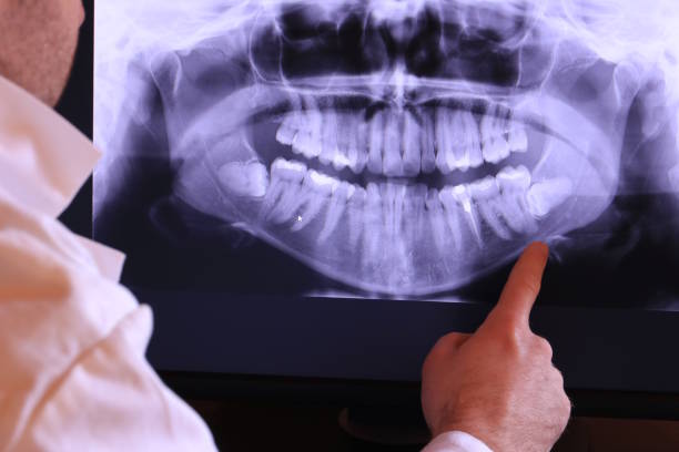 Best Emergency Cosmetic Dentistry in Morongo Valley, CA