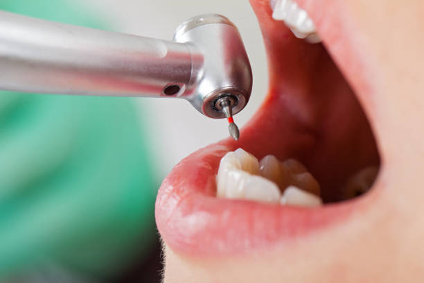 Best Mobile Emergency Dentist in Morongo Valley, CA